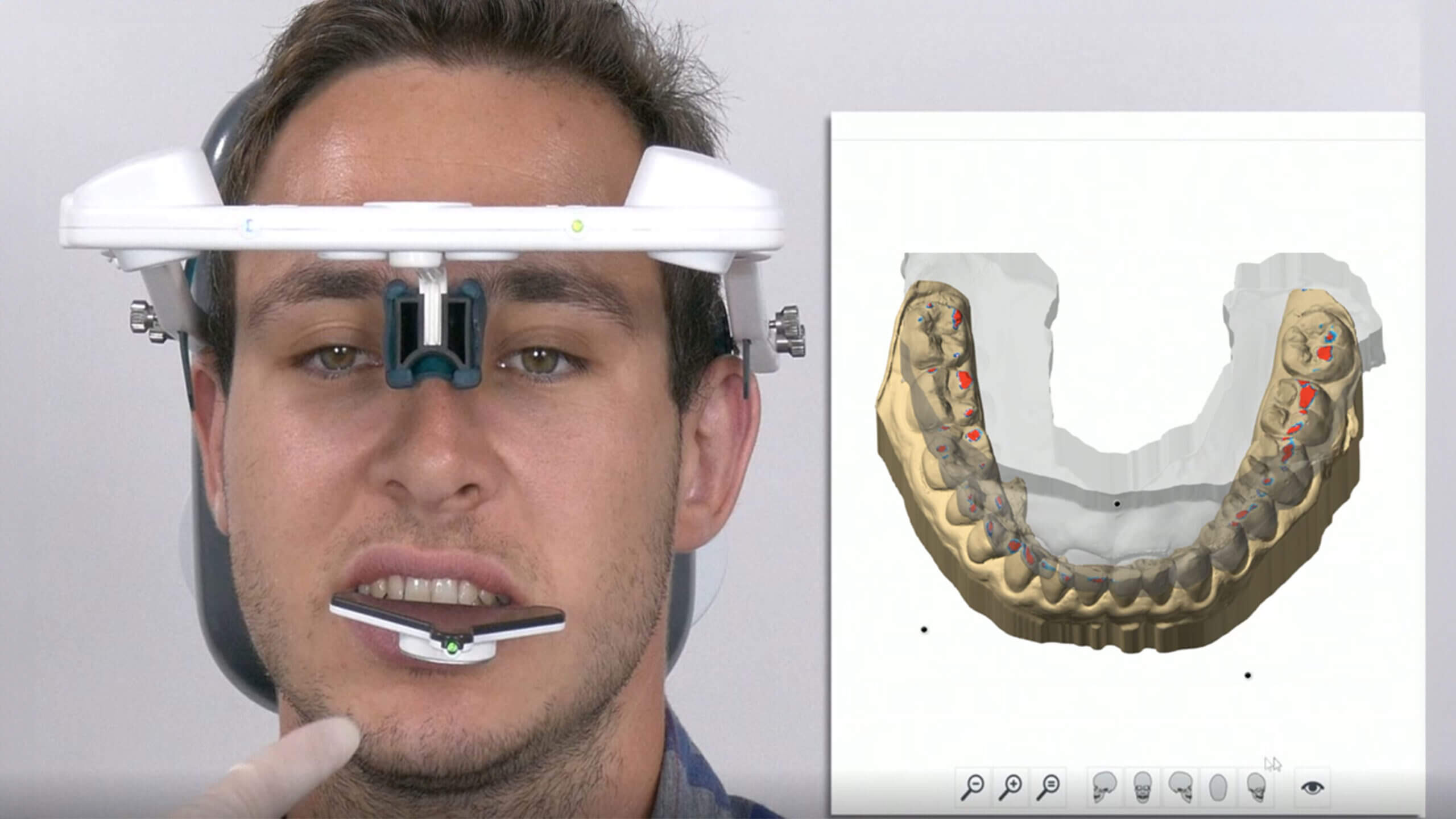 zebris Kieferregistriersystem JMA-Optic
