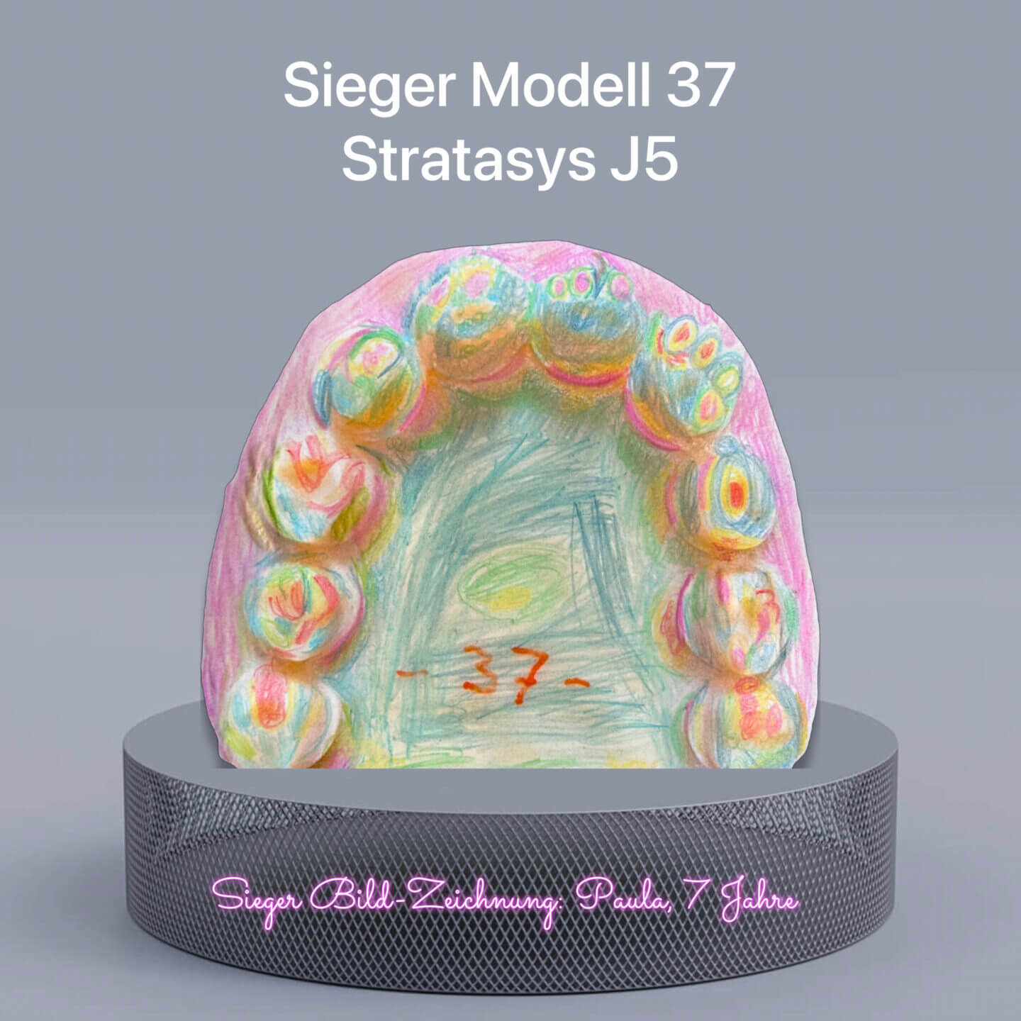 Abb. 5: Siegermodell 37, gedruckt auf einem Stratasys J5 und dekoriert von der siebenjährigen „Nachwuchszahntechikerin“ Paula