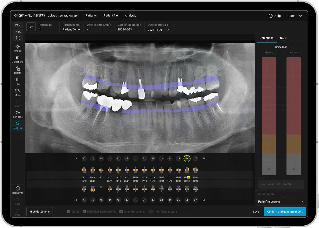Align X-ray Insights: softwarebasierte computergestützte Erkennungslösung